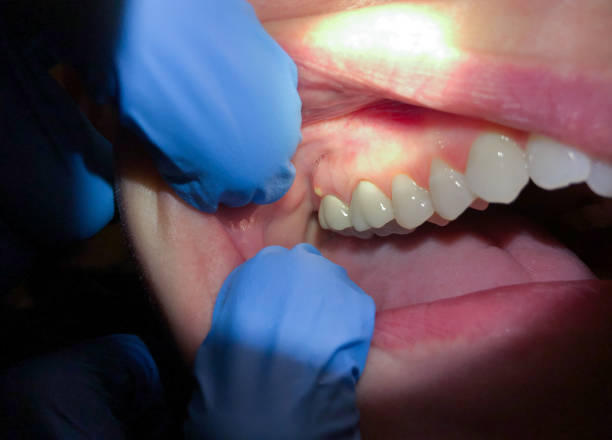 Best Emergency Dental Care for Trauma or Injury in Hollins, VA