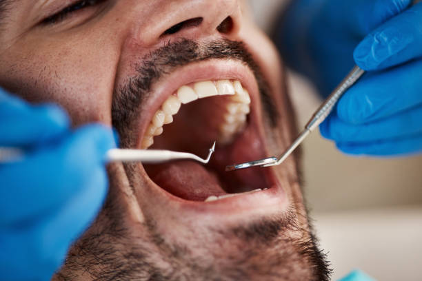 Best Emergency Dental Surgery in Hollins, VA